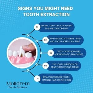 A Comprehensive Guide to Understanding Tooth Extraction