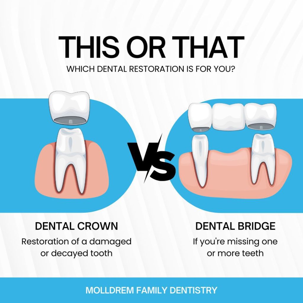 Dental Crowns vs. Bridges Which One is Right for You? Molldrem Family Dentistry