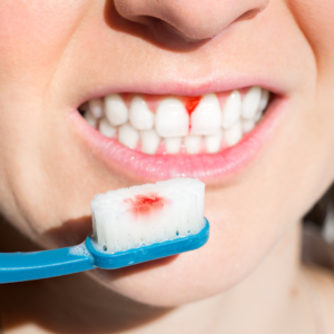 Understanding Gum Disease: