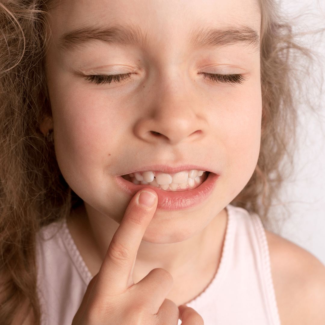 Children’s Dental Care Handling Thumbsucking Lakeville