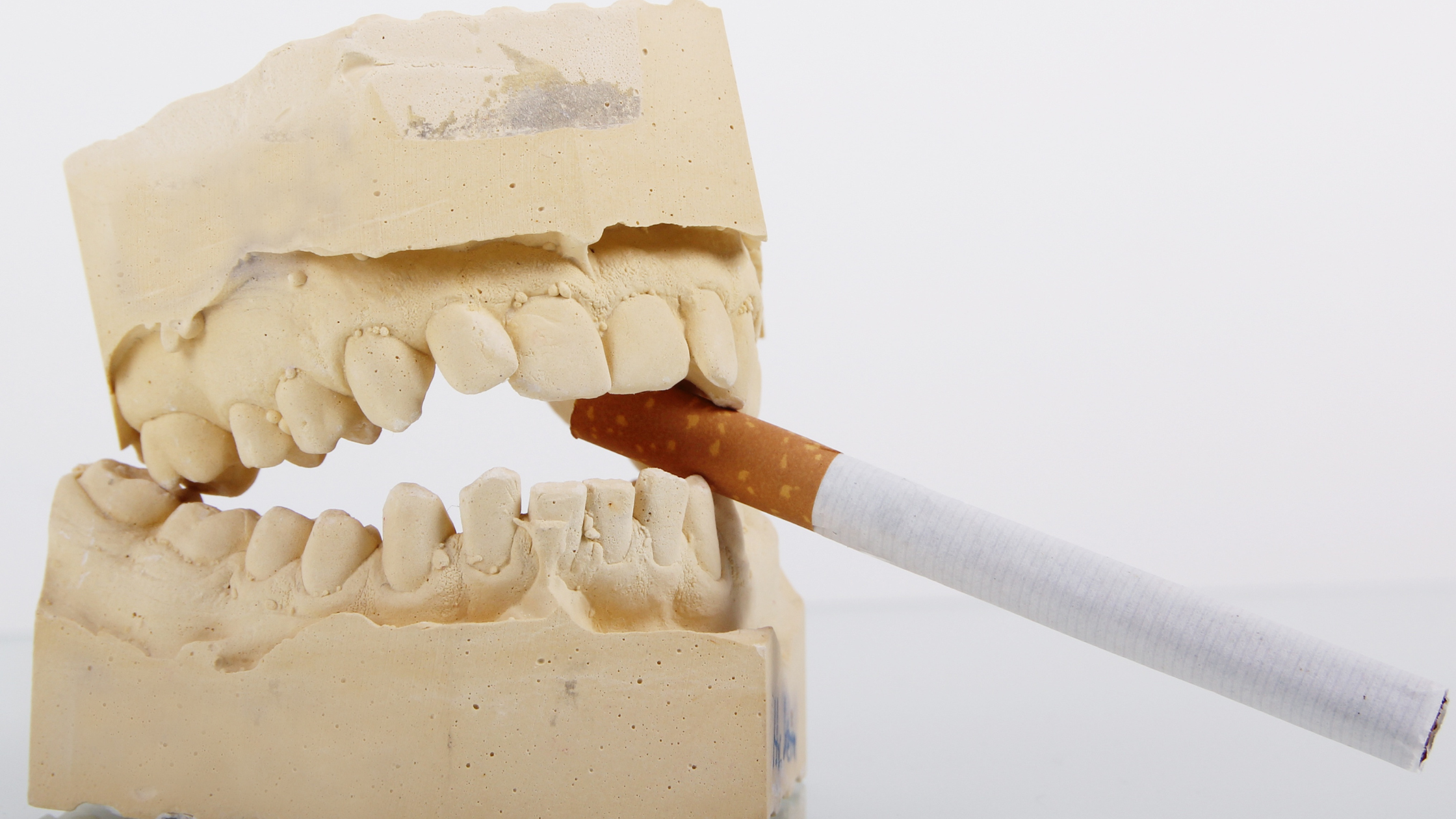 The Impact of Smoking on Oral Health: Risks and Tips for Quitting